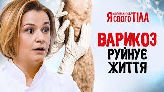 Варикоз не дает почувствовать себя женщиной - Я соромлюсь свого тіла | ЗДОРОВЬЕ | ЛЕЧЕНИЕ | МЕДИЦИНА