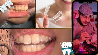 ClearAlign: Transform Your Smile Discreetly #dental#smile umair toothfairy @Umairazeem8553