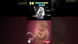 Scan of a 36 weeks baby in the womb  36 weeks fetus ️ Baby Development #pregnancy #baby