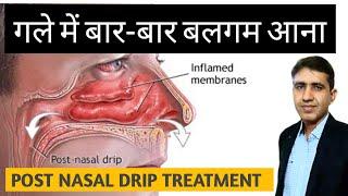 PND | Post Nasal Drip Treatment | गले में बार -बार बलगम आना | Homeopathic Treatment For PND