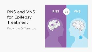 RNS and VNS for Epilepsy Treatment - Know the Differences