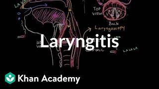 Laryngitis diagnosis, treatment, and prevention | NCLEX-RN | Khan Academy