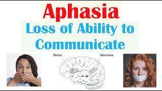 Aphasia | Types (Broca’s, Wernicke’s, Global), Causes, Signs & Symptoms, Diagnosis, Treatment