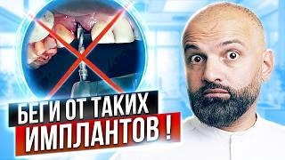 НИКОГДА не ставь ТАКИЕ импланты! Стоматологи молчат об этом! Вся правда об имплантации зубов