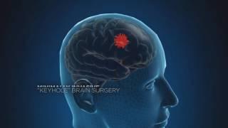 Defining Medicine - Neurology TV