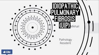 Idiopathic pulmonary fibrosis (Usual interstitial pneumonia)