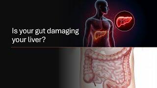 The Gut-Liver Connection: Can Probiotics Help Fight Liver Disease? | NAFLD | Fibrosis | AI plus ppt