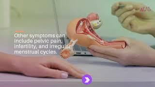 Understanding Uterine Polyps: Causes, Diagnosis, and Treatment Options