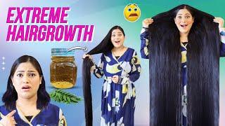 Most Powerful Diy to Stop Hairfall, Get Triple Hairgrowth for Rs0 गंजे सर पर बाल उगाने का आसानतरीका