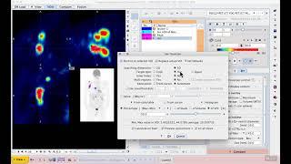 H1E7 VOI analysis