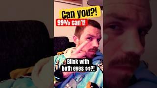 Can You Blink / Wink with BOTH Eyes at the Same Time?  | The Challenge You Didn’t Know You’d Fail