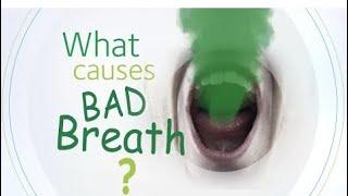 Maxaa sababa Af-urka sideena loo daween karaa|Halitosis”bad breath”.