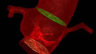 Aortic root in red pseudocolor