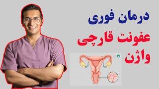 vaginitis treatment | درمان قطعی عفونت قارچی واژن + علائم و نشانه ها