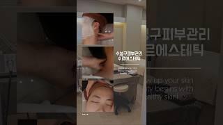 수르에스테틱 | 수성구피부관리 #대구피부관리샵 #대구피부관리 #수성구피부관리 #수르에스테틱 #물광필 #물광피부 #피부관리 #에스테틱
