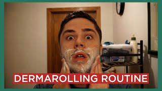 HOW TO DERMAROLL YOUR FACE | MY ROUTINE