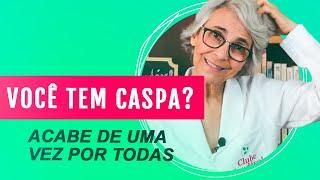 Como acabar com a caspa e seborréia naturalmente de uma vez por todas