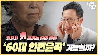 '이곳'만 괜찮으면 중년에도 윤곽수술 충분히 가능합니다! - 닥터 김윤호