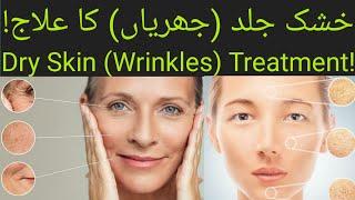 (خشک جلد (جھریاں) کا علاج!) Dry Skin (Wrinkles) Treatment!  || #YouTubeShorts |