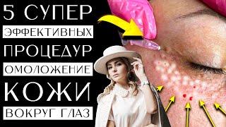 5 супер эффективных процедур / Омоложение кожи вокруг глаз