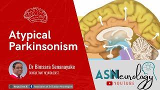 Atypical Parkinsonism by Dr Bimsara Senanayake