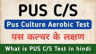 Pus C/S Test in hindi | Pus Culture Test in hindi | Symptoms of PUS C/S | Pus Culture Aerobic Test