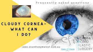 FAQ - Cloudy cornea - What can I do - Dr Anthony Maloof, Sydney