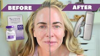 MICROCURRENT FACIAL | Does Microcurrent Ruin Botox | ZIIP Halo Review