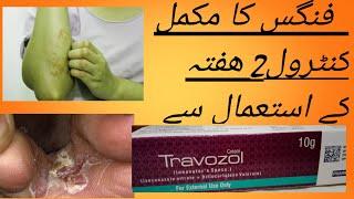 baby rashes diaper rashes kharish ka ilaj Travazol cream travocart cream/ paon phatny ka ilaj istam