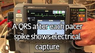 LifePak 15- Transcutaneous Pacing