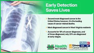 Lung cancer screenings with Marshall Health Network