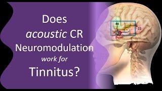 Is CR Neuromodulation Effective for Tinnitus?