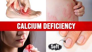 Best Home Test for a CALCIUM DEFICIENCY