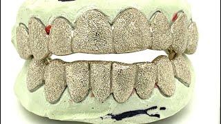 How Does White Gold DIAMOND DUST Look vs Silver Diamond Dust Grillz from Seattle Gold Grills?