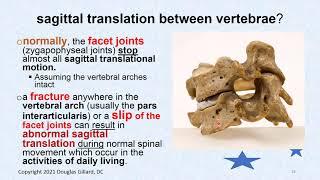 Biomechanics of Vertebra Movement: (Up-dated)