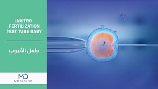 Invitro fertilization test tube baby - Dr Antoine Hanoun @mdmedicine.network