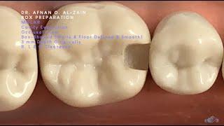 Box cavity preparation for composite restoration on a molar (#36) - Arabic عربي