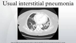 Usual interstitial pneumonia