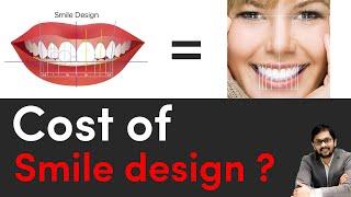 Cost of smile design ? | Dr Ankit khasgiwala | Seraphic dental clinic Indore