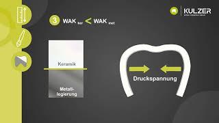 Einfach erklärt: Was ist WAK in Zusammenhang mit der Zahntechnik?