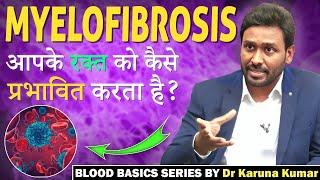 Myelofibrosis symptoms and Treatment | मायलोफाइब्रोसिस  | Dr. Karuna Kumar