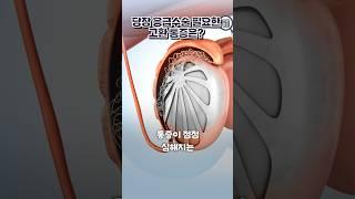 당장 응급수술 필요한 고환통증은?