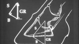 Breaking Away - How Concern Over Breakover Has Sabotaged Real Gait Analysis