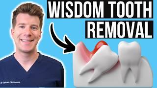 Doctor explains Wisdom Tooth Removal