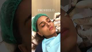 Profhilo: The Ultimate Rejuvenating Treatment | Aesthetics Lab