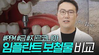 임플란트 보철물 뭐가 좋을까? (PFM, 금, 지르코니아)