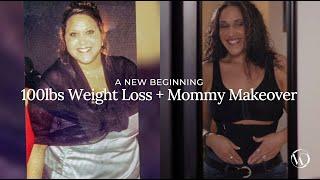 Full Body Transformation After 110lb Weight Loss | Hope's Story