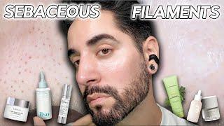 How I Get Rid Of Sebaceous Filaments & Congested Pores