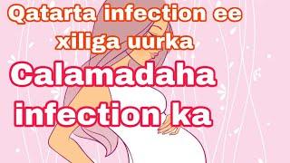 calaamadaha infection ee xaliga uurka Qatarta infection ee xiliga Uurka haadi anaan ladawyn