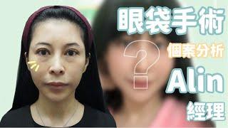 眼袋手術內開還是外開好？劉淳熙醫師個案分析-美魔女Alin眼袋  | 愛惟美診所